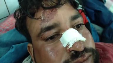 सिमरिया: महोड़ में चलती बाइक के सामने दो लकड़बग्घा आने से बाइक हुई अनियंत्रित, दो लोग घायल, जिला अस्पताल रेफर