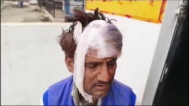 रायबरेली: कोनचन्दा मऊ के पास मामूली विवाद में दबंगों ने अधेड़ की जमकर की पिटाई, अधेड़ व्यक्ति को जिला अस्पताल में कराया गया भर्ती