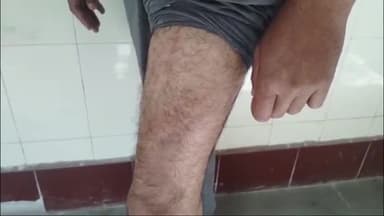 रायबरेली: मूसापुर गांव में दबंगों ने स्कूल से लौट रहे शिक्षक पर लोहे की राड से किया हमला, जिला अस्पताल में चल रहा इलाज