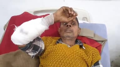 मिलक: मिलक के साहू मोहल्ला में एक खूंखार कुत्ते ने एक व्यक्ति पर जानलेवा हमला कर घायल किया, व्यक्ति जिला अस्पताल में भर्ती