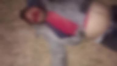 जयसिंहनगर: पथरवाह पुलिया के पास स्कूटी अनियंत्रित होकर गिरने से एक व्यक्ति घायल, डायल 100 ने अस्पताल पहुंचाया