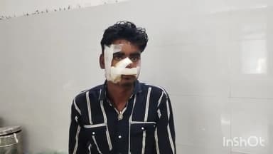 कोचस: कोचस खैर कॉलेज के पास बाइक से गिरकर एक लड़का हुआ घायल