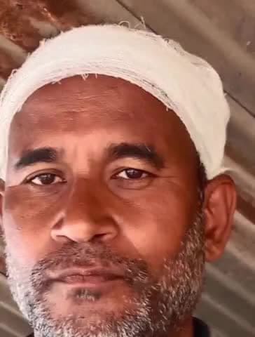 घाटमपुर: स्योदी गांव में युवक पर धारदार हथियार से हुआ जानलेवा हमला, पुलिस पर कार्रवाई न करने का आरोप