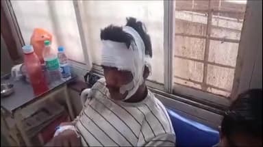 शिवपुरी नगर: बदरवास से घर लौट रहे दो सगे भाईयों को काटी गांव के पास ट्रैक्टर ने टक्कर मारी, दोनों गंभीर रूप से घायल, जिला अस्पताल में भर्ती