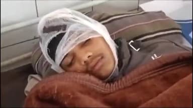 शिवपुरी नगर: बैराड़ में युवक ने 9वीं के छात्र के छोटे भाई को पीटा, देखने गए छात्र पर भी पत्थर फेंका