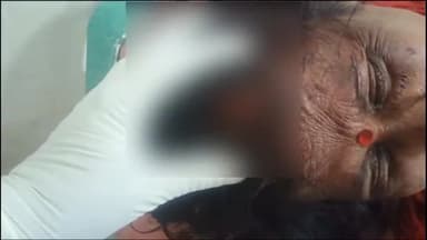 अररिया: बस स्टैंड के समीप जमीन विवाद को लेकर हुई मारपीट में एक महिला जख्मी, सदर अस्पताल में भर्ती