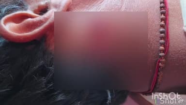 ब्यौहारी: भोलाहरी गांव में जमीनी विवाद को लेकर एक युवक पर टांगी से किया गया हमला, सिविल अस्पताल में उपचार जारी