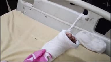 दीगोद: सिमलीया थाना इलाके के नेशनल हाइवे 27 फोरलेन पर पोलायकलां में 2 मोटरसाइकिलों की टक्कर में युवक गंभीर घायल