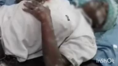 सिरोंज: भोपाल रोड क्षेत्र में निर्माणाधीन मकान की दीवार गिरने से मजदूर घायल, अस्पताल में उपचार जारी