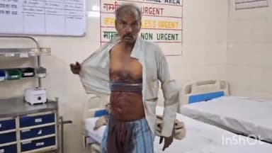 बरेली: सीबीगंज थाना क्षेत्र के पस्तौर में घर में सो रहे व्यक्ति पर बदमाशों ने धारदार हथियार से किया हमला, व्यक्ति हुआ घायल