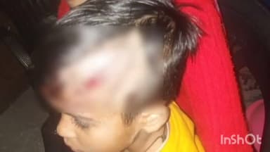 धौलछीना: तल्ला शेराघाट के उमेर गांव में गुलदार ने 6 वर्षीय बच्चे पर हमला कर किया घायल, परिजनों के शोर से बची मासूम की जान