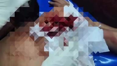 गिर्वा: मल्ला तलाई चौराहे पर युवक पर चाकूबाजी करने वाले 2 बाल अपचारी को अंबामाता थाना क्षेत्र से किया डिटेन