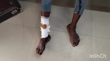 सासाराम: कंचनपुर गांव में साइकिल और बाइक के बीच हुई टक्कर, एक लड़का हुआ घायल