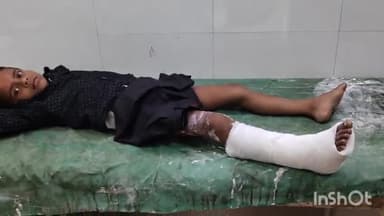 सासाराम: तेंदुआ गांव में बाइक की चपेट में आने से एक लड़का हुआ जख्मी