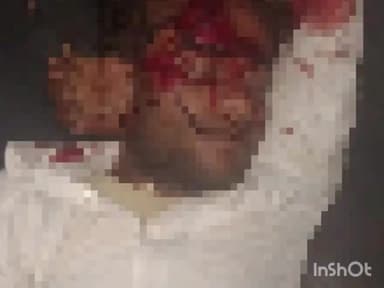 बल्देवगढ़: मनपसार के पास अज्ञात वाहन चालक ने बाइक सवार को टक्कर मारी, बाइक सवार गंभीर रूप से घायल