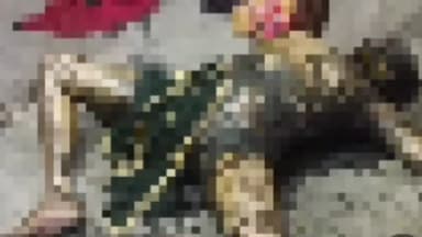 हनुमानगढ़: टाउन के प्रेम नगर में कमरे में आग लगने से जिंदा #जली एक महिला जिला अस्पताल लाने पर चिकित्सकों ने किया मृत घोषित