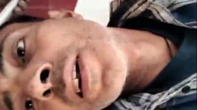 ठाकुरद्वारा: लालपुर गांव के पास तेज रफ्तार कार ने युवक को मारी टक्कर, युवक गंभीर रूप से घायल