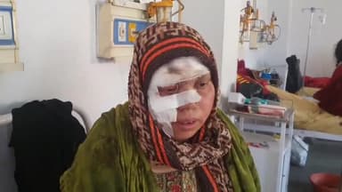 रामपुर: लाल फाटक के पास तेज रफ्तार बाइक सवार ने दूसरे बाइक सवार दंपति को मारी टक्कर, घटना में 2 बच्चे समेत चार घायल