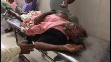 टीकमगढ़: वर्माताल गांव में जमीनी विवाद में दो लोगों ने वृद्ध व्यक्ति और महिला के साथ की मारपीट, पुलिस ने कराई एमएलसी