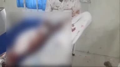 अररिया: फारबिसगंज प्लेटफार्म पर ट्रेन की चपेट में आने से एक व्यक्ति का पैर कटा, इलाज के लिए सदर अस्पताल में भर्ती