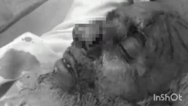 पलवल: आलीमेव गांव में पुरानी रंजिश के चलते चाचा पर हमला, नाक काटी गई और फायरिंग की गई