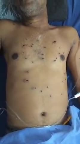 मेदिनीनगर (डालटनगंज): निमियां में आपसी रंजिश में युवक को गोली मारी गई, एमआरएमसीएच में इलाज के बाद रांची रिम्स रेफर किया गया, जेएमएम नेता समेत दो गिरफ्तार