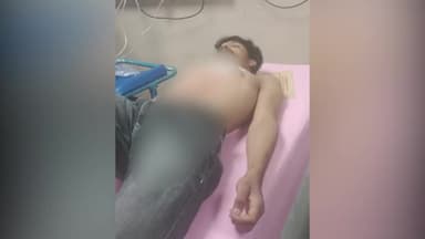 इंदौर: रावजी बाजार में मुखबिरी के शक पर बदमाश ने युवक पर किया हमला, घायल