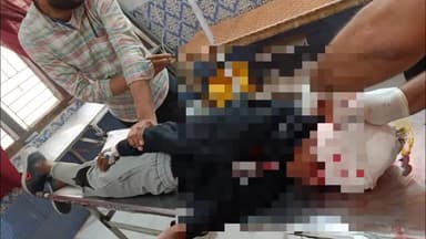 बेल्थरा रोड: शास्त्री नगर के पास ई-रिक्शा से टकराई तेज रफ्तार बाइक, एक युवक हुआ जख्मी