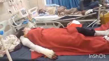 फिरोज़ाबाद: कबीर नगर में चूड़ी जुडाई करते समय डिब्बी में मिट्टी का तेल डालने पर लगी आग, चार लोग झुलसे