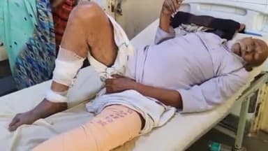 कर्वी: चित्रकूट के खरौध गांव में अपने खेत से घर लौटते बाइक सवार ने वृद्ध को मारी टक्कर, घायल को जिला अस्पताल में भर्ती किया गया