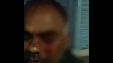 सागर नगर: बड़ा बाजार में लटका तार बाइक चालक की आंख में लगा, खून निकला