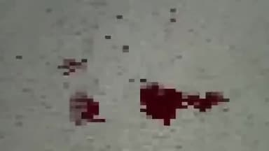 कुंडम: पिपरिया में पुरानी रंजिश को लेकर 3 लोगों ने कुल्हाड़ी से हमला कर एक युवक को किया घायल, मामला दर्ज