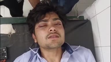 धनौरा: गजरौला हाईवे स्थित मॉडल शॉप के पास पेपर देकर घर लौट रहे छात्र पर दबंग छात्रों ने किया जानलेवा हमला, हालत गंभीर