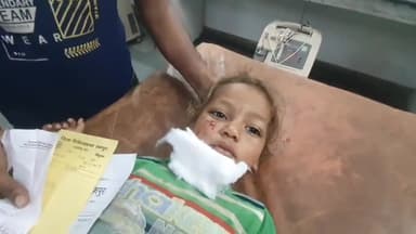 रामपुर: पादपुरी गांव में आवारा कुत्तों के झुंड ने बच्चों पर जानलेवा हमला कर किया घायल, बच्चों के पिता ने कराया इलाज