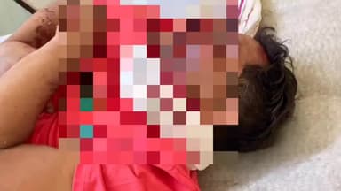 मिहोना: परसला मोड़ पर बस ने बाइक में टक्कर मारी, बाइक सवार युवक घायल