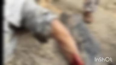 खकनार: ग्राम केरपानी में गिट्टी से भरा डंपर एक व्यक्ति से टकराया, गंभीर रूप से घायल