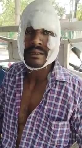 कानपुर: छावनी के गंगापुल पर कार की टक्कर से गंभीर रूप से घायल हुए ई-रिक्शा चालक ने पुलिस पर लगाए आरोप