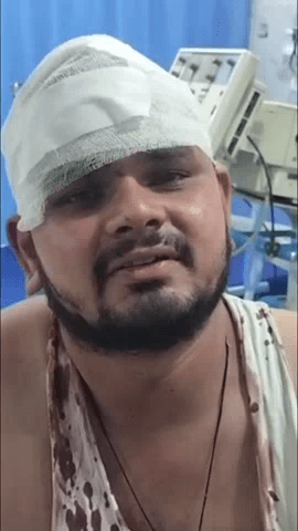 मेरठ: लिसाड़ी गेट क्षेत्र में ताबड़तोड़ फायरिंग, पास में खड़े राहगीर के सिर को छुती हुई निकली गोली, घायल