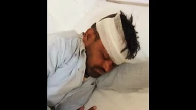 बिलारी: गांव पंडिया में दर्जी को दौड़ाकर पीटा, घर में घुसकर स्वजन पर किया हमला