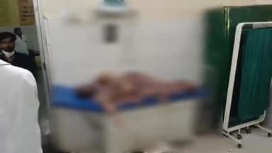 सीतापुर: संदिग्ध अवस्था में हुसैनगंज निवासी महिला ने खुद को आग लगाकर आत्महत्या की कोशिश की, गंभीर अवस्था में उपचार जारी