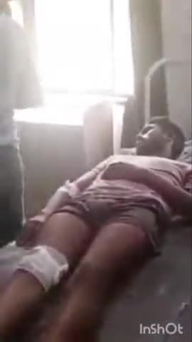 त्योंदा: बासौदा मार्ग पर आवारा पशु को बचाने के प्रयास में मोटरसाइकिल अनियंत्रित होकर गिरी, युवक घायल