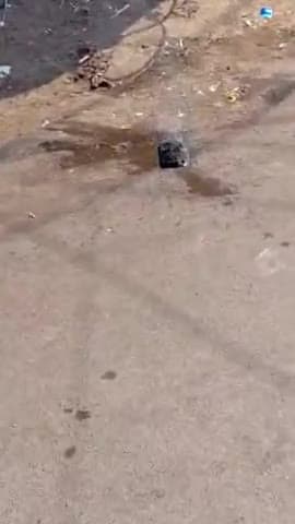 मंदसौर: शहर के देहली गेट पर युवक के हाथ में रखे मोबाइल में अचानक लगी आग, जला युवक का अंगूठा; घटना का वीडियो आया सामने