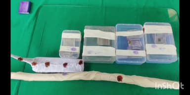 पडरौना: पड़रौना कोतवाली पुलिस ने नगर में चोरी व मारपीट करने वाले अंतर्जनपदीय गैंग का किया खुलासा, 2 चोर हुए गिरफ्तार