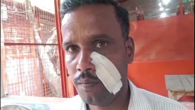 कोल: सासनी गेट में जानलेवा हमले के मामले में पीड़ित पर दबंग बना रहे मुकदमा वापस लेने का दबाव, एसएसपी से की शिकायत