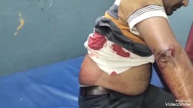 मिर्ज़ापुर: युवक पर जानलेवा हमला करने के मामले में जिगना कोतवाली में एक नामजद और दो अज्ञात के खिलाफ मुकदमा दर्ज