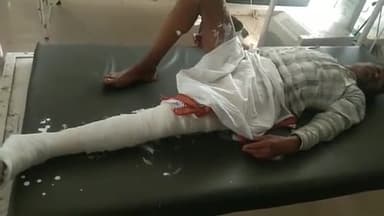 हमीरगढ़: चित्तौड़ रोड के समीप दो बाइकों की हुई जोरदार भिड़ंत, हादसे में बाइक सवार एक व्यक्ति हुआ घायल