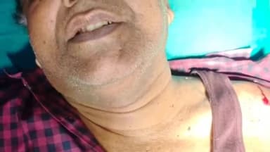 रातू: चटकपुर में आकाश ज्वेलर्स के दुकानदार बसंत कुमार पर लूट के प्रयास में अज्ञात अपराधियों ने गोली चलाई, घायल