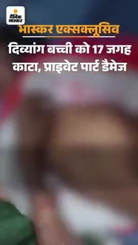 #UP #Rampur में रेप की शिकार 11 वर्षीय दलित बच्ची पिछले 4 दिन से होश में नहीं आई है #national #viral #Haryana #GIRAKHPUR