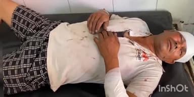 बागपत: सूरजपुर महनवा पुलिया के निकट हाइवे पर गाली-गलौच को लेकर दो पक्षों में हुई मारपीट, तीन लोग घायल