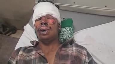 पीपलदा: इटावा क्षेत्र में करवाड निवासी युवक तेज रफ्तार मोटरसाइकिल के फिसलने से गंभीर घायल, MBS अस्पताल में भर्ती